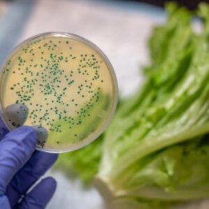 Enteric Panel STX (Shiga Toxin 1 (STX 1) 2 (STX 2)