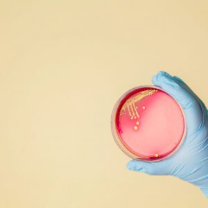 MARCoNS Nasopharyngeal - Bacterial & Fungal Culture