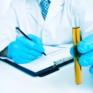Urine Elements Test
