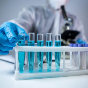 Anti-Cardiolipin Antibodies