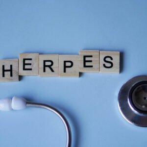 Herpes Simplex Virus 1 and 2 (HSV)