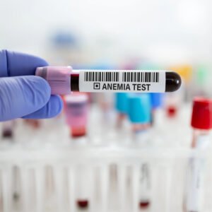 Anaemia Autoimmunity (Vit B12)