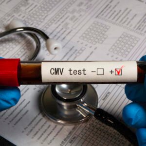 Cytomegalovirus (CMV)