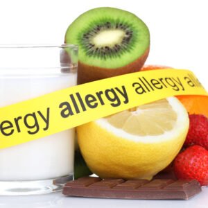 IgG4 General 240 Foods