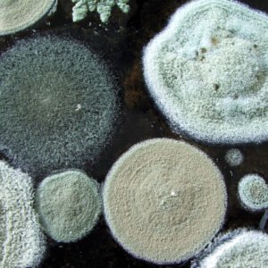 Mycotoxin Exposure Extensive Test – Urine
